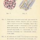 А.М. Хлопков. Рисунки срезов сердца