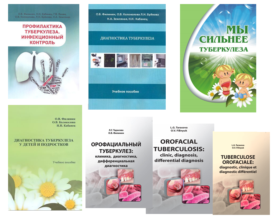 Основные научные издания кафедры фтизиатрии и пульмонологии в период с 2010 по 2020 г.